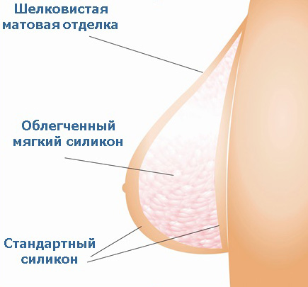 Cтруктура экзопротеза