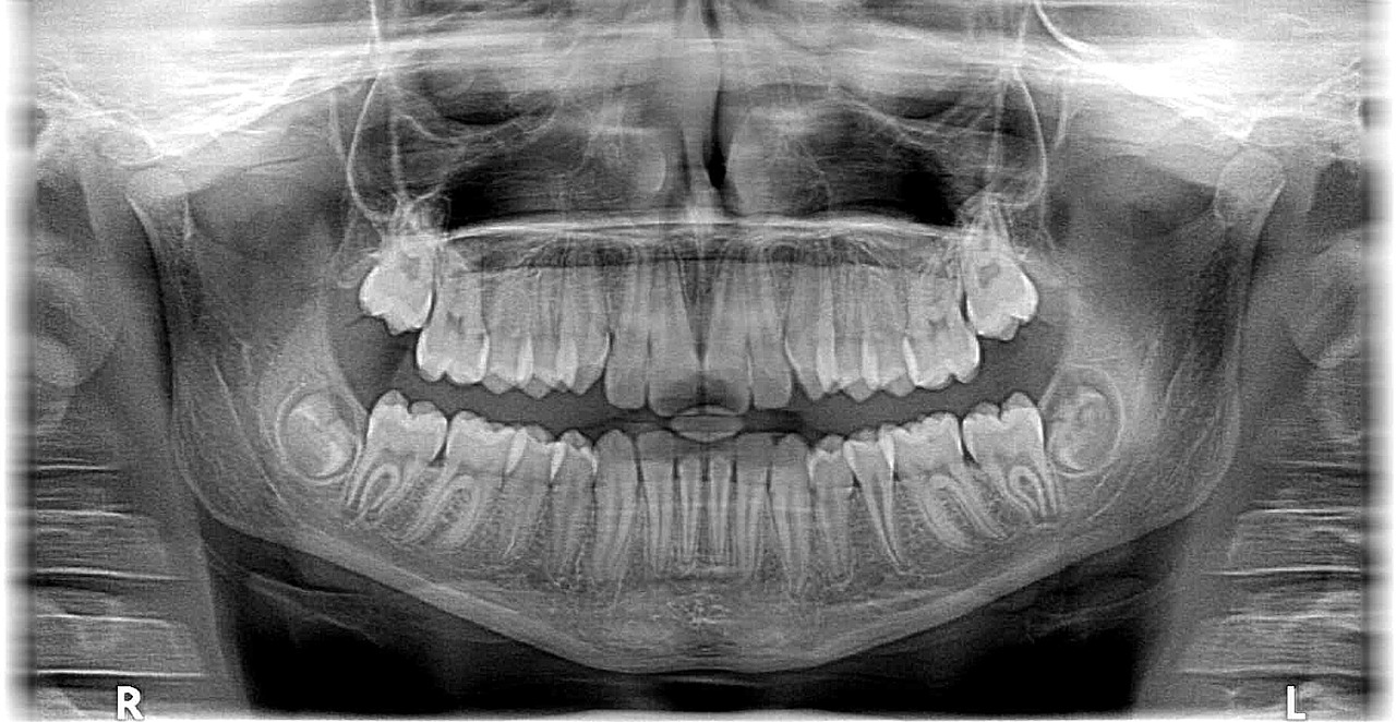 Рентгенография (радиография) - что это такое, суть метода - «Про Здоровье»  ⚕️